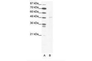 Image no. 1 for anti-DEK Oncogene (DEK) (N-Term) antibody (ABIN202370)