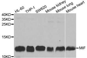 Image no. 1 for anti-Macrophage Migration Inhibitory Factor (Glycosylation-Inhibiting Factor) (MIF) antibody (ABIN3021945)