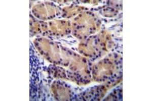 Image no. 1 for anti-Cytochrome P450, Family 2, Subfamily S, Polypeptide 1 (CYP2S1) (AA 406-436), (C-Term) antibody (ABIN951784)