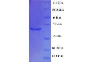 Image no. 1 for TAF12 RNA Polymerase II, TATA Box Binding Protein (TBP)-Associated Factor, 20kDa (TAF12) (AA 1-161), (full length) protein (His-SUMO Tag) (ABIN5711345)