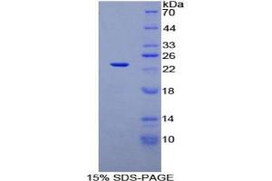 Image no. 1 for Signaling threshold Regulating Transmembrane Adaptor 1 (SIT1) protein (ABIN3011674)