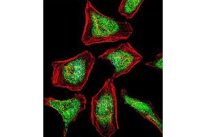 Image no. 2 for anti-Activating Transcription Factor 7 (AFT7) (AA 68-96), (N-Term) antibody (ABIN1881079)