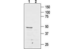 anti-Angiotensin II Receptor, Type 2 (AGTR2) (AA 21-35), (Extracellular), (N-Term) antibody