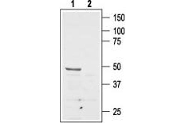 anti-Angiotensin II Receptor, Type 2 (AGTR2) (AA 21-35), (Extracellular), (N-Term) antibody