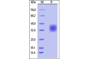 Image no. 2 for CD47 (CD47) (AA 19-139) (Active) protein (His tag,AVI tag,Biotin) (ABIN4949015)