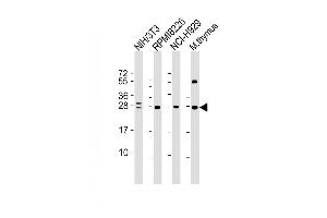 Image no. 1 for anti-FGFR1 Oncogene Partner 2 (FGFR1OP2) antibody (ABIN4909561)