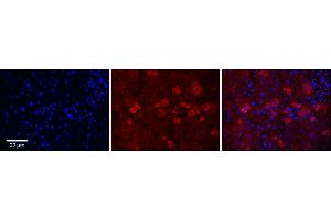 Image no. 3 for anti-Cytochrome P450, Family 4, Subfamily F, Polypeptide 3 (CYP4F3) (N-Term) antibody (ABIN2777012)