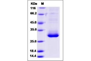 Image no. 1 for RAB27B, Member RAS Oncogene Family (RAB27B) (AA 2-215) protein (His tag) (ABIN2006662)