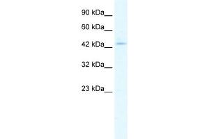 anti-Chloride Intracellular Channel 5 (CLIC5) (Middle Region) antibody