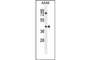 Image no. 3 for anti-GTP-Binding Protein 8 (GTPBP8) (AA 129-158), (Middle Region) antibody (ABIN952657)