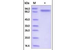 Image no. 1 for Sema Domain, Immunoglobulin Domain (Ig), Transmembrane Domain (TM) and Short Cytoplasmic Domain, (Semaphorin) 4A (Sema4a) (AA 33-683) protein (His tag) (ABIN2181737)