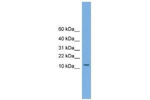 Image no. 1 for anti-Melanoma Antigen Family A, 5 (MAGEA5) (N-Term) antibody (ABIN633132)