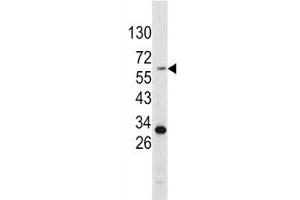 Image no. 6 for anti-Tyrosinase (TYR) (AA 486-513) antibody (ABIN3029406)