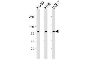 Image no. 3 for anti-Gen Endonuclease Homolog 1 (GEN1) (AA 60-89), (N-Term) antibody (ABIN653446)