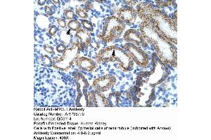 Image no. 2 for anti-Protein L-Myc (MYCL) (Middle Region) antibody (ABIN2776440)