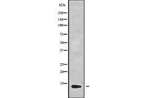 anti-Guanylate Cyclase Activator 2B (Uroguanylin) (GUCA2B) (Internal Region) antibody