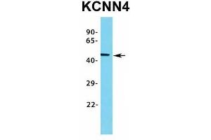 Image no. 6 for anti-Potassium Intermediate/small Conductance Calcium-Activated Channel, Subfamily N, Member 4 (KCNN4) (C-Term) antibody (ABIN2776147)