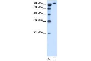 Image no. 2 for anti-Solute Carrier Family 6, Member 18 (SLC6A18) (Middle Region) antibody (ABIN630375)