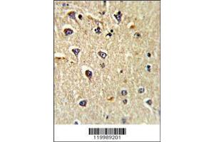 Image no. 1 for anti-Activated Leukocyte Cell Adhesion Molecule (ALCAM) (AA 58-87), (N-Term) antibody (ABIN389410)