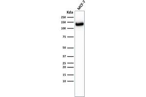 Image no. 1 for anti-Cadherin 1, Type 1, E-Cadherin (Epithelial) (CDH1) antibody (ABIN6941299)