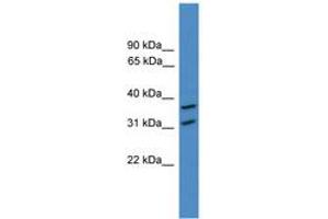 Image no. 1 for anti-OTU Domain Containing 6A (OTUD6A) (AA 51-100) antibody (ABIN6745381)
