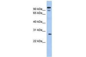 Image no. 1 for anti-Voltage-Dependent Anion Channel 3 (VDAC3) (AA 35-84) antibody (ABIN6742549)