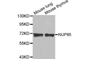 Image no. 1 for anti-Nucleoporin 85kDa (NUP85) antibody (ABIN1873989)