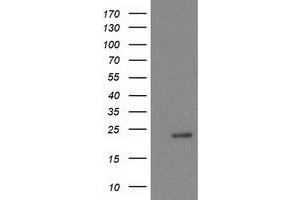 Image no. 1 for anti-NADH Dehydrogenase (Ubiquinone) 1 beta Subcomplex, 9, 22kDa (NDUFB9) (AA 3-179) antibody (ABIN1491362)
