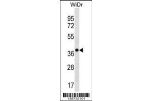 Western Blotting (WB) image for anti-Chloride Channel Accessory 3, Pseudogene (CLCA3P) (Center) antibody (ABIN2160142)