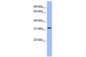 Image no. 1 for anti-T-Cell Leukemia Homeobox 1 (TLX1) (N-Term) antibody (ABIN6742786)