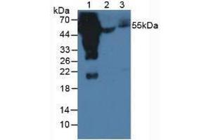 Western Blotting (WB) image for Rabbit anti-Human IgG4 (AA 222-327) antibody (ABIN2862700)