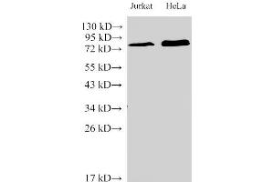 IL-6 Receptor anticorps