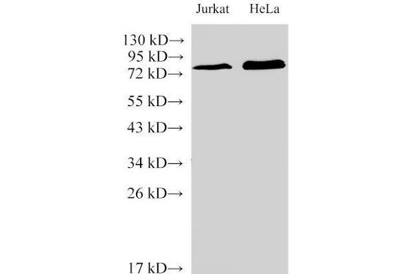 IL-6 Receptor 抗体