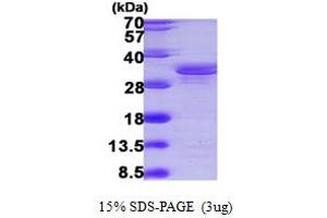 Image no. 1 for SGT1, Suppressor of G2 Allele of SKP1 (SUGT1) (AA 115-365) protein (His tag) (ABIN667341)