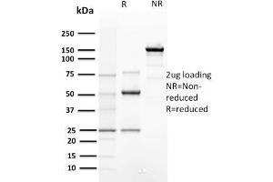 Image no. 5 for anti-Cyclin E1 (CCNE1) (AA 10-176) antibody (ABIN6940994)