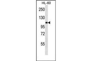 Image no. 2 for anti-alpha-Glucosidase (AGLU) (AA 173-203), (N-Term) antibody (ABIN950380)