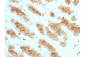 Image no. 1 for anti-Keratin Acidic (AE1) antibody (ABIN3023883)