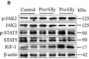 Image no. 3 for anti-Janus Kinase 2 (JAK2) (pTyr1007), (pTyr1008) antibody (ABIN740955)