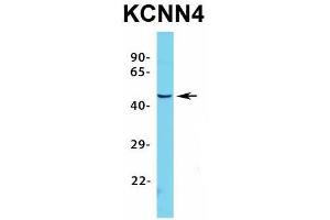 Image no. 3 for anti-Potassium Intermediate/small Conductance Calcium-Activated Channel, Subfamily N, Member 4 (KCNN4) (C-Term) antibody (ABIN2776147)