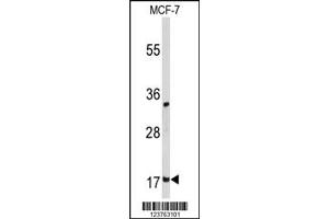 Western Blotting (WB) image for anti-Destrin (Actin Depolymerizing Factor) (DSTN) antibody (ABIN2158605)