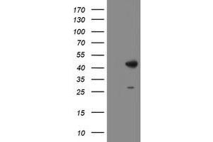 Image no. 1 for anti-Dihydrolipoamide Branched Chain Transacylase E2 (DBT) antibody (ABIN1497771)