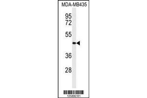 Western Blotting (WB) image for anti-Transmembrane Protein 30B (TMEM30B) antibody (ABIN2158066)