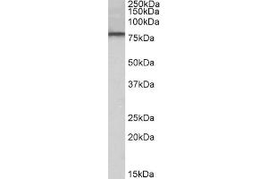 Image no. 1 for anti-Dual-Specificity tyrosine-(Y)-phosphorylation Regulated Kinase 1A (DYRK1A) (N-Term) antibody (ABIN5539713)