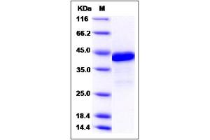 Image no. 1 for HMG Box-Containing Protein 1 (HBP1) (AA 208-345), (Mature) protein (GST tag) (ABIN2006064)