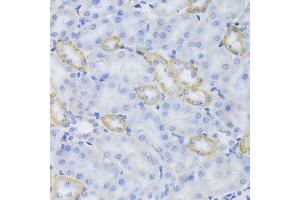 Image no. 1 for anti-Mitochondrial Ribosomal Protein S30 (MRPS30) antibody (ABIN6144043)