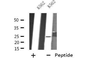 Image no. 1 for anti-FEV (ETS Oncogene Family) (FEV) antibody (ABIN6257177)