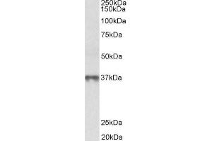 Image no. 1 for anti-Methionine Adenosyltransferase II, beta (MAT2B) (N-Term) antibody (ABIN5539558)