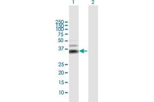 Image no. 3 for anti-Moloney Sarcoma Oncogene (MOS) (AA 1-346) antibody (ABIN517987)
