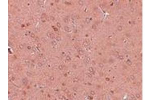 Immunohistochemistry (IHC) image for anti-Golgi Membrane Protein 1 (GOLM1) (Middle Region) antibody (ABIN1030941)