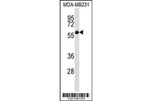 Image no. 1 for anti-Histone H4 Transcription Factor (HINFP) (AA 317-346) antibody (ABIN656553)